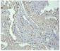 Anti-PPT1 Antibody Picoband™ (monoclonal, 10F3)